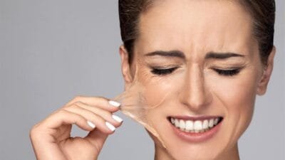 كل ما تحتاج معرفته عن تقشير البشرة الكيميائي 14 تقشير البشرة الكيميائي