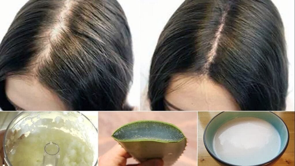 أسباب وطرق علاج تساقط الشعر المتاحة 1 علاج تساقط الشعر